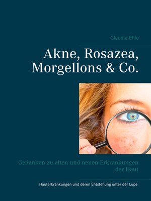 cover image of Akne, Rosazea, Morgellons & Co.